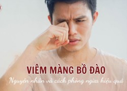 Viêm màng bồ đào: Nguyên nhân và cách phòng ngừa hiệu quả